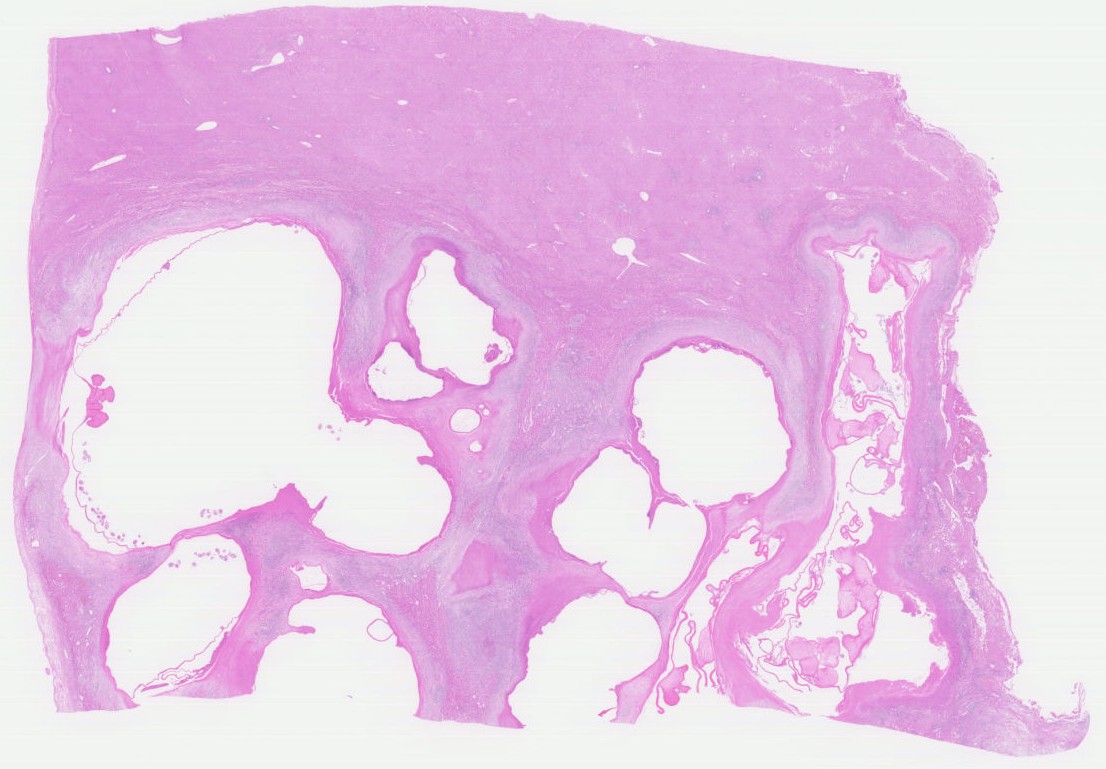 病理学研究のイメージ画像